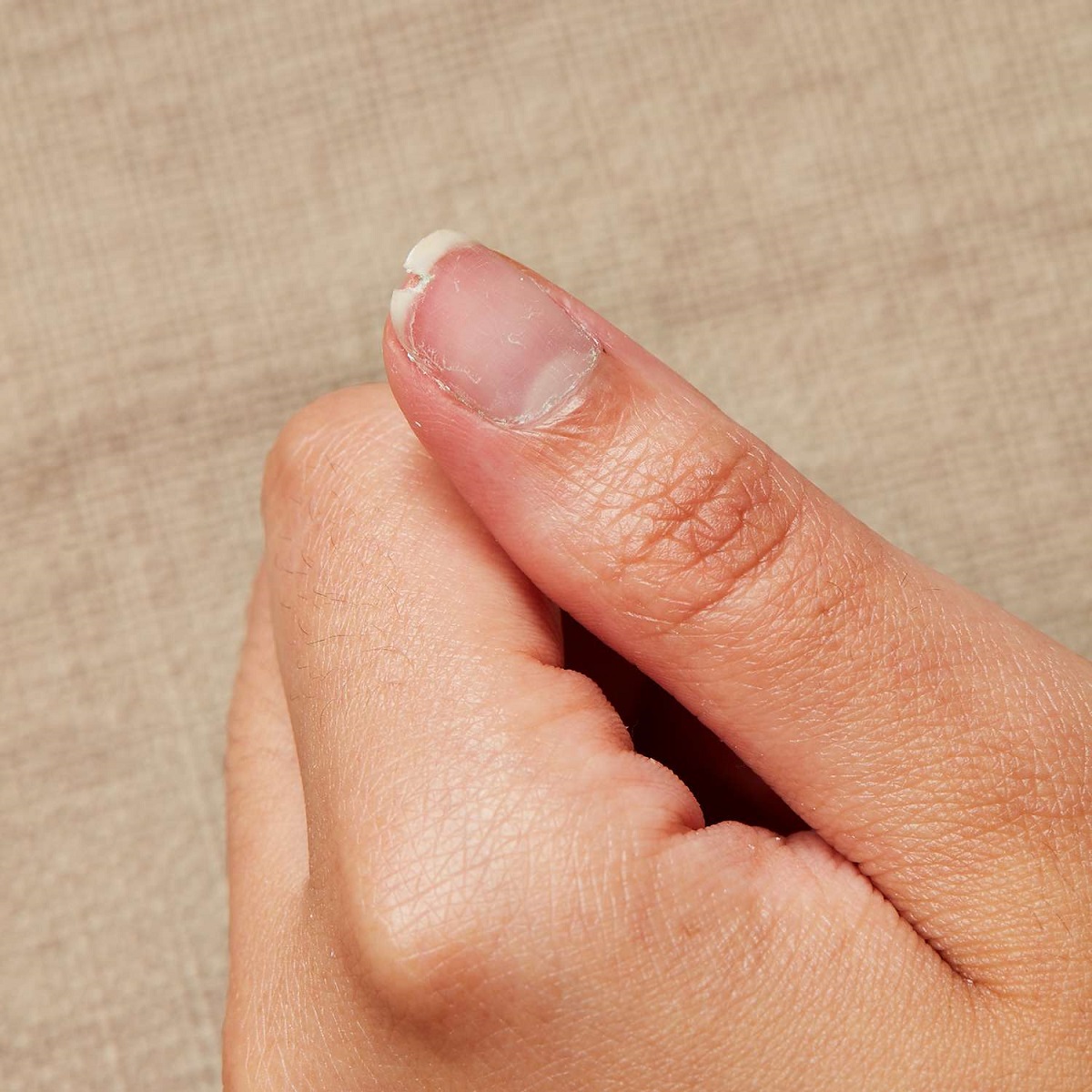 broken nail