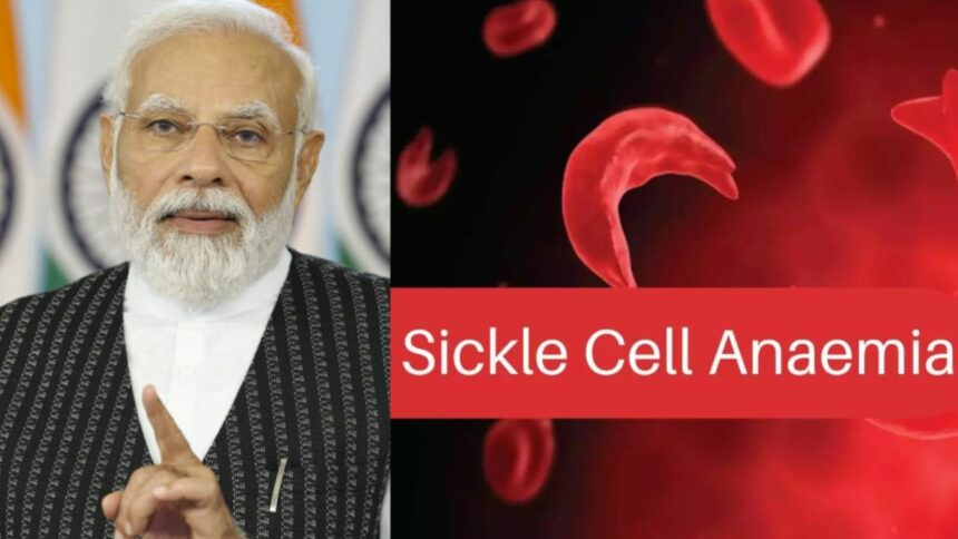 ગુજરાતમાં સિકલ સેલ એનિમિયા નિયંત્રણ હેઠળ 1 કરોડથી વધુ લોકોનું સ્ક્રીનિંગ 1 sickle cell anaemia