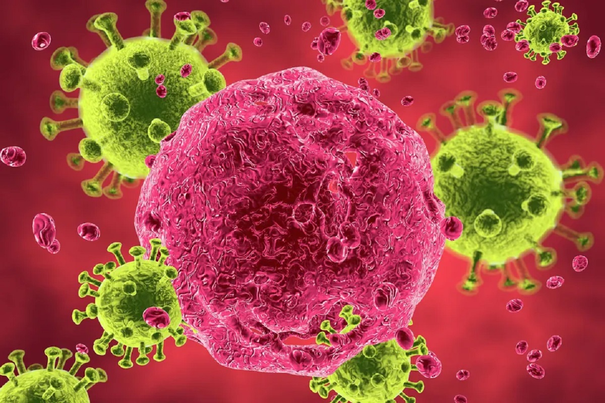 hiv aids
