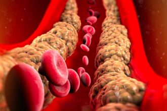 bad cholesterol