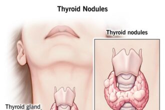 thyroid nodules