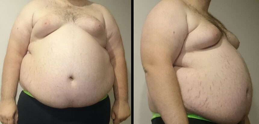જાડા થવા માટેના ઉપાયો જાણો 1 motu pet big somach obesity