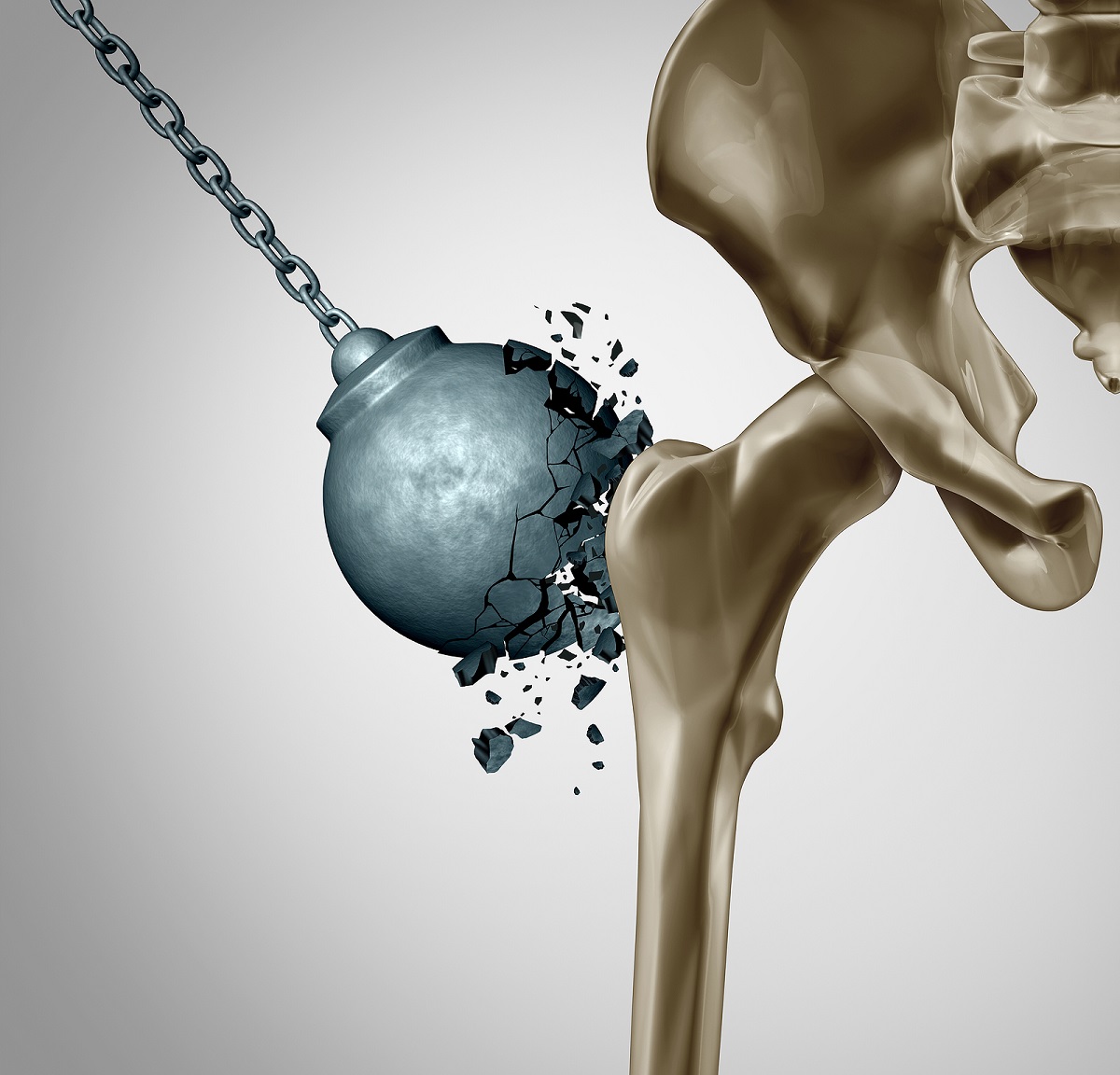 strong bone