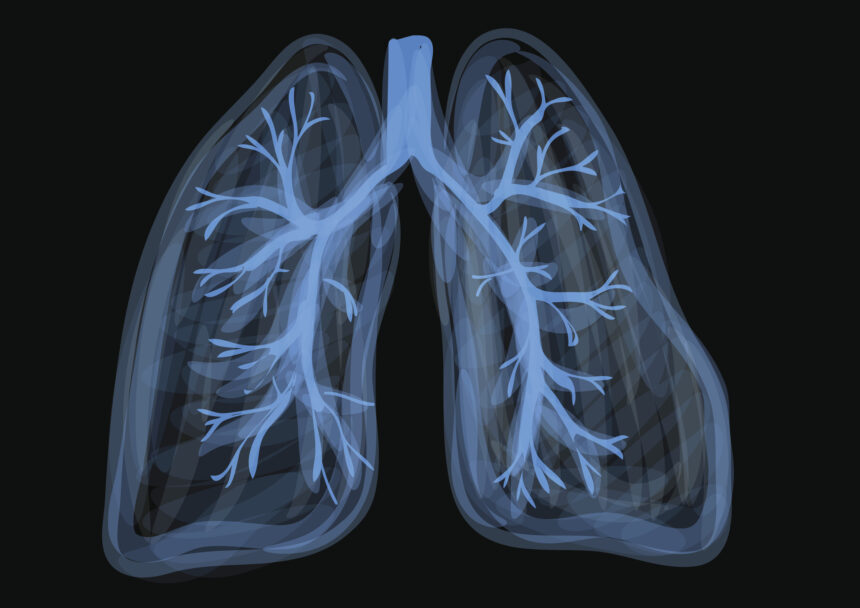 lungs