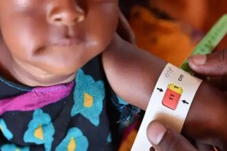 Gujarat Child Malnutrition Deaths