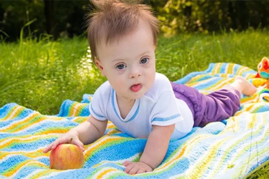 World Down Syndrome Day : "ભારતમાં દર વર્ષે 30,000થી વધુ બાળકો ડાઉન સિન્ડ્રોમ સાથે જન્મે છે" 1 ferfr 1
