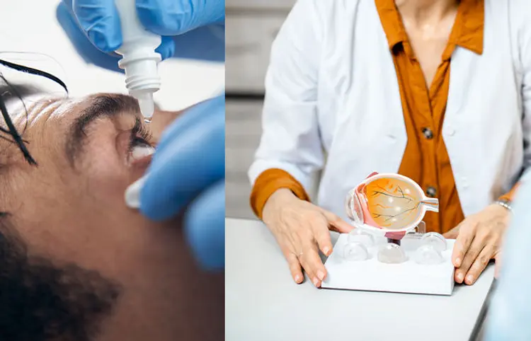 Steroid Eye Drops Glaucoma Risk: સ્ટીરોઈડ આઈ ડ્રોપ્સથી ઝામરનો ખતરો, 10 લાખ લોકોએ દૃષ્ટિ ગુમાવી 1 Steroid Eye Drops Glaucoma Risk
