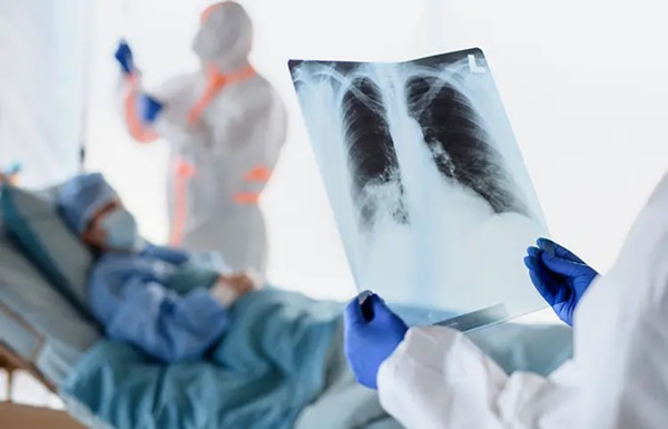 TB Spine Paralysis Risk
