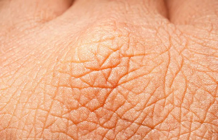 Artificial human skin: કૃત્રિમ માનવ ત્વચા જેવી હાઈડ્રોજેલની શોધ, ઘા ઝડપથી રુઝાશે, વૈજ્ઞાનિકોને મહત્વપૂર્ણ સફળતા 1 Artificial human skin