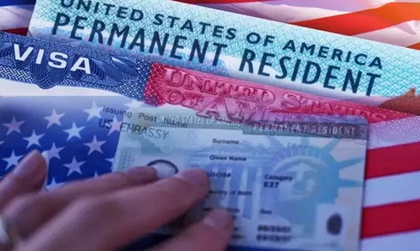 Marriage Green Card Filing Rules: અમેરિકન નાગરિક સાથે લગ્ન કરીને ગ્રીન કાર્ડ મેળવવું બન્યું મુશ્કેલ, USCIS એ નિયમો બદલ્યા, જાણો હવે શું કરવું 1 ASdcs