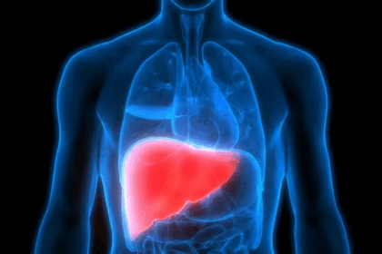 Unhealthy liver