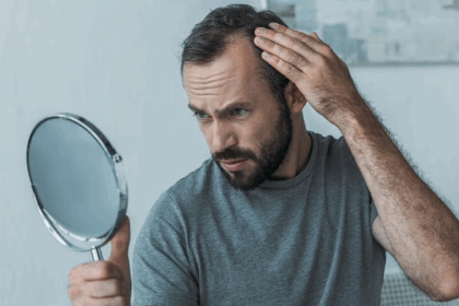 Vitamin deficiency causes hair loss