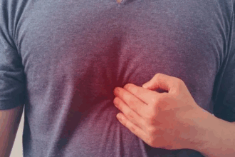 Home Remedies For Acidity