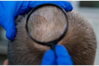 Hair Fall Tips