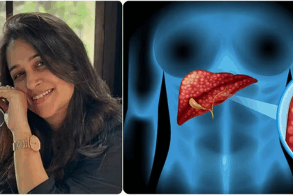 Liver tumor symptoms and causes