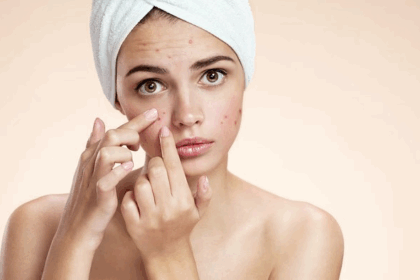 Remedies To Reduce Pimples