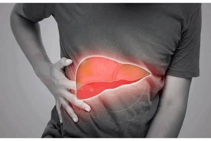 Fatty Liver