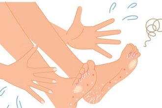 Foot Fungus Prevention