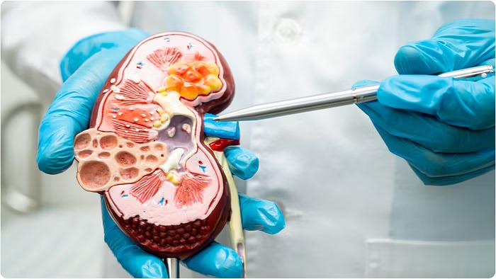 Kidney Cancer Day