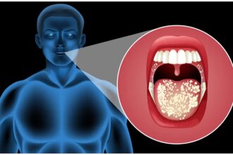 What causes recurrent mouth ulcers
