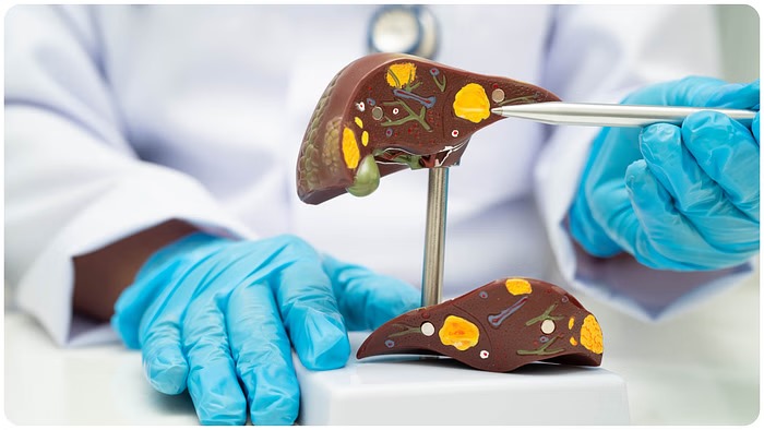 Fatty Liver Symptoms