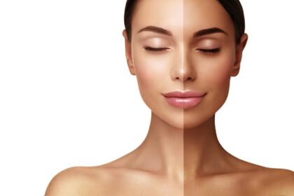 Monsoon Tanning Removal