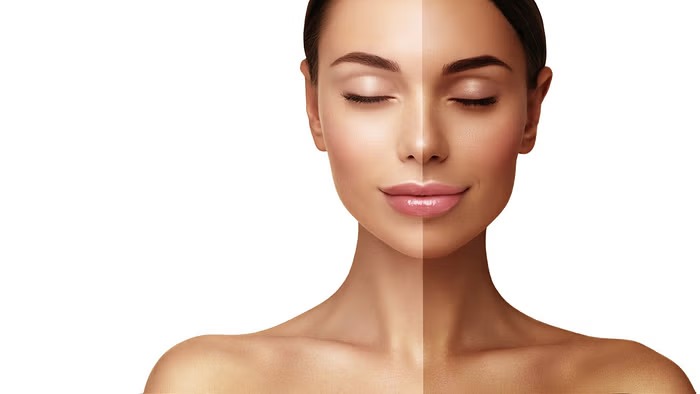 Monsoon Tanning Removal