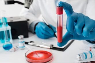 What to Eat in Anemia