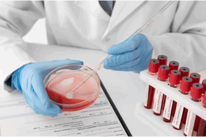 Health Checkup For Men After 40