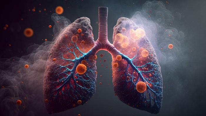 World Lung Cancer Day 2025: