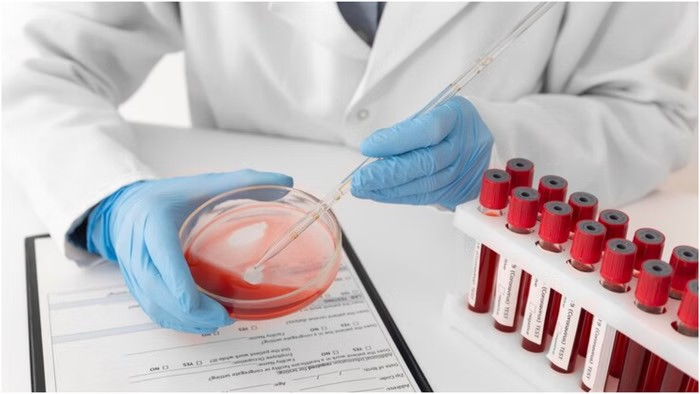 Important Medical Test For Women