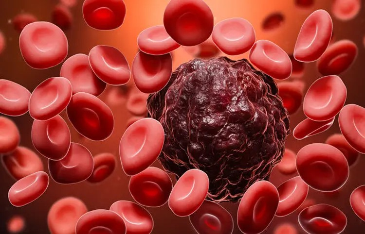 World Leukemia Day