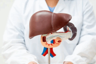 Fatty Liver Diet Tips