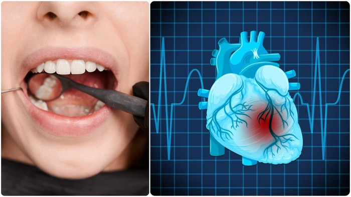Heart Health: શું મૌખિક ગંદકી હૃદયરોગનું કારણ બની શકે છે? હૃદય રોગને રોકવા માટે આ બાબતો જાણો. 1 yr6ergrc