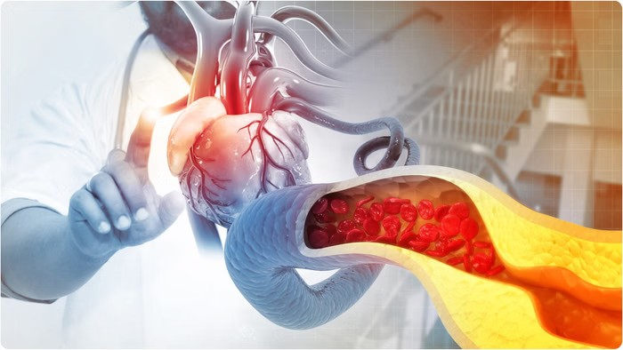 Breakfast skipping cholesterol: સવારનો નાસ્તો નથી કરતા? સાવધાન! તમારી આ એક ભૂલ વધારી શકે છે હાર્ટ એટેકનું જોખમ, જાણો હાઈ કોલેસ્ટ્રોલનું અસલી કારણ 1 k52e248z