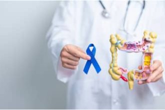 stomach cancer 3b231e3351788f485b6c7f4b3b75dddd
