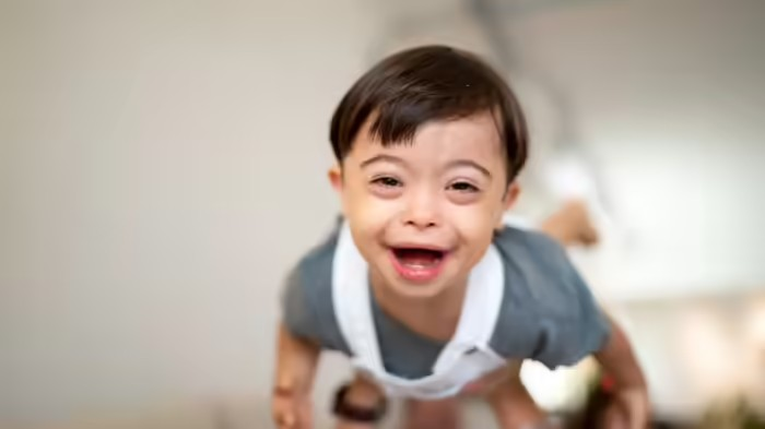 World Down Syndrome Day: આમિર ખાનની ફિલ્મ 'સિતારે જમીન પર' માં જણાવવામાં આવેલ 21મા ક્રોમોઝોમવાળી બીમારીનું સત્ય 1 koiwdodk