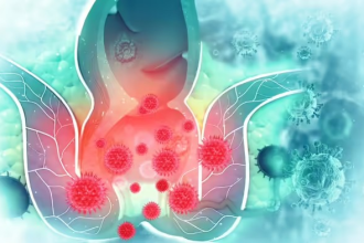 Piles Symptoms and Prevention