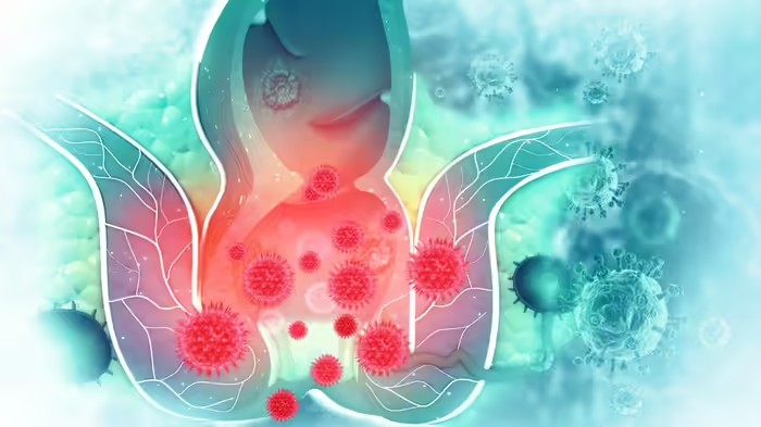 Piles Symptoms and Prevention: દરરોજની 3 આદતો વધારે છે પાઈલ્સનું જોખમ, શું બવાસીરથી કેન્સર થઈ શકે છે, એક્સપર્ટ પાસેથી જાણો બચાવના ઉપાયો 1 Piles Symptoms and Prevention