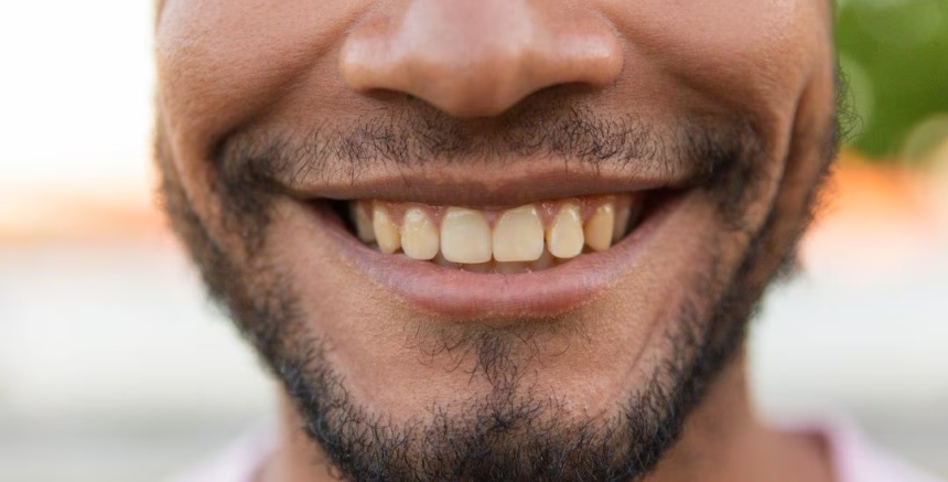 Excessive Sugar Oral Health Risks: શું ખાંડ ખાવાથી પીળા થાય છે દાંત, જાણો આનાથી ડાયાબિટીસ સિવાય બીજી શું થઈ શકે છે તકલીફો? 1 5i4nz5c5