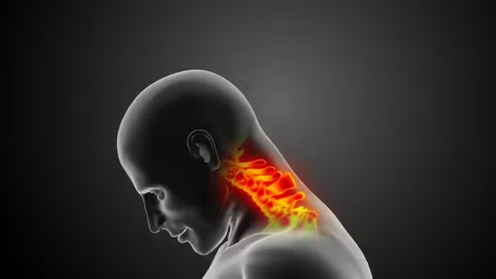 Cervical Spondylosis Symptoms: સર્વાઈકલનો દુખાવો છે કે બીજું કંઈ? 6 લક્ષણોથી હંમેશા માટે ખતમ થશે કન્ફ્યુઝન 1 Cervical Spondylosis Symptoms