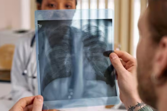 Pneumonia Symptoms
