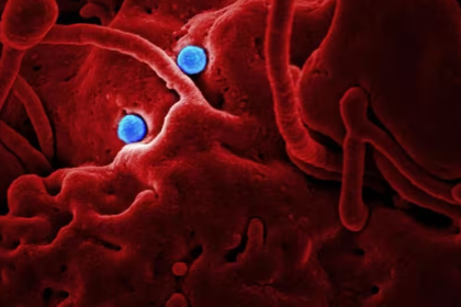 Ebola Vaccine Serum Institute