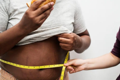 Obesity Myths and Facts