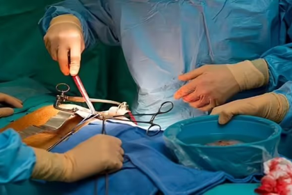 Kidney Transplant Transparency