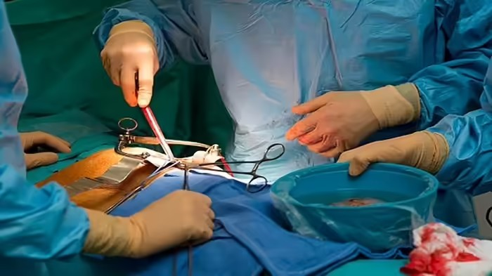 Kidney Transplant Transparency