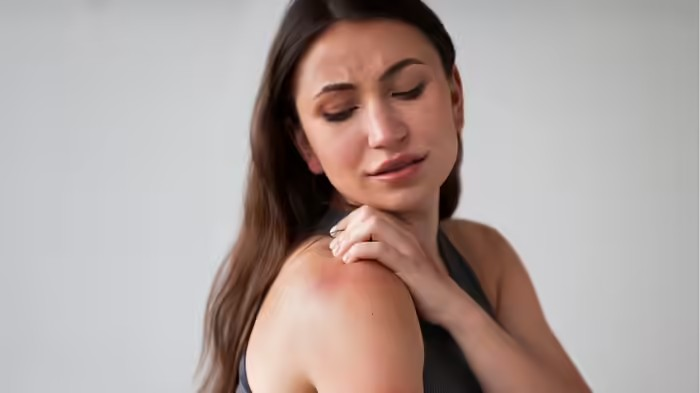 Summer skin infection