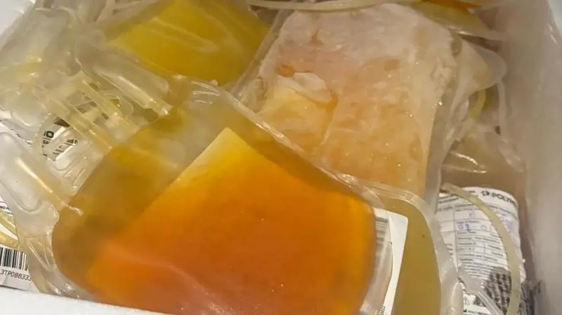 Blood Plasma Scam: બ્લડ પ્લાઝ્મામાં ભેળસેળનું ખતરનાક કૌભાંડ, અમદાવાદમાં પકડાયું નકલી પ્લાઝ્માનું મોટું રેકેટ 1 Blood Plasma Scam