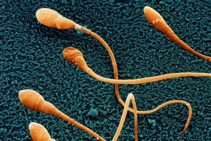 Stem Cell Sperm Research