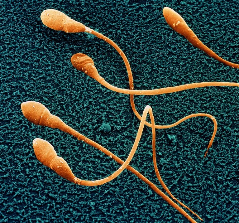 Stem Cell Sperm Research: પ્રજનન ક્ષેત્રમાં મોટી શોધ, વૈજ્ઞાનિકોએ માનવ સ્ટેમ સેલમાંથી શુક્રાણુ બનાવવાની પ્રક્રિયામાં મેળવી સફળતા 1 Stem Cell Sperm Research